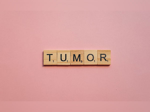 Immunotherapy treatments are avoided by tumours by forming temporary structures, finds study
