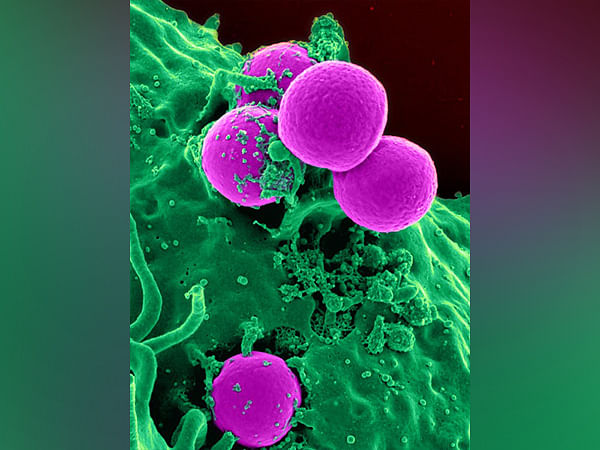 Study sheds light on blood cells' precancerous 'clonal expansion'
