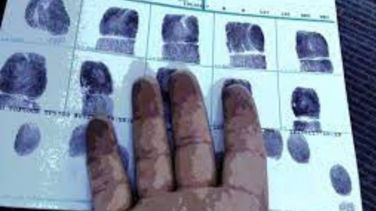 4 held for performing ‘fingerprint surgeries’ to smuggle people to Kuwait