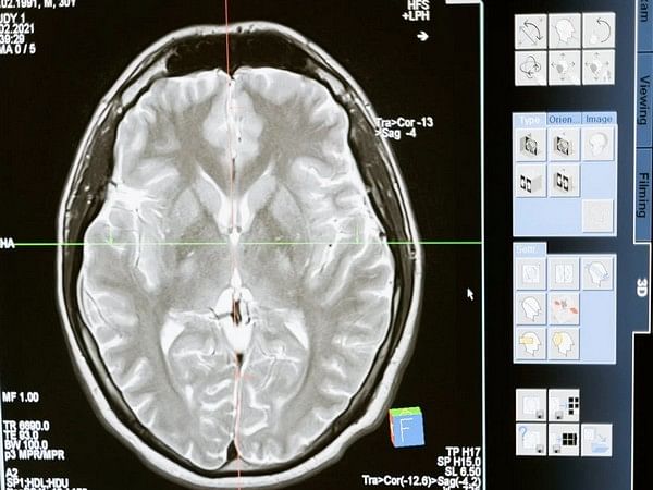 Study reveals cerebellum is important for survival