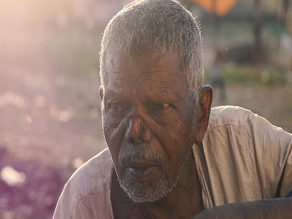 Leprosy has potential to regenerate livers: Research