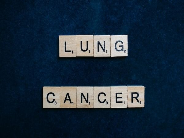 Tumour matrix profiling can predict some lung cancers' progression