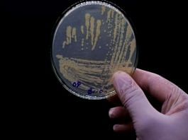 New research reveals relationship between oral bacteria and diseases