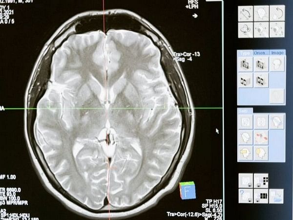 Researchers make major discovery about mammalian brains