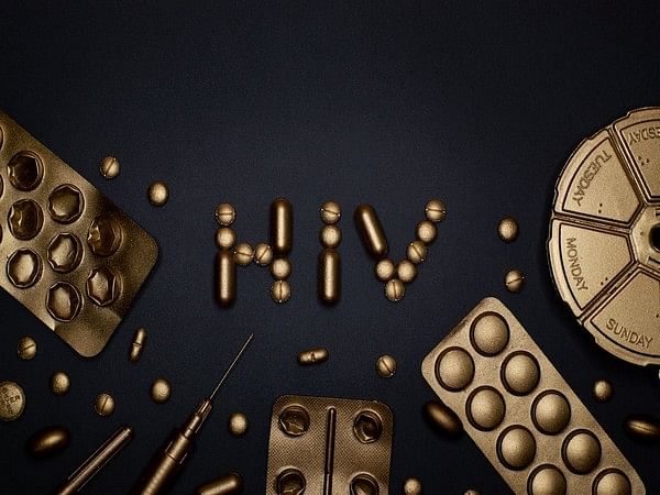 Study: HIV speeds up body's aging processes soon after infection