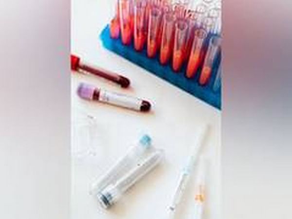 Blood test can predict metastasis risk in melanoma: Study