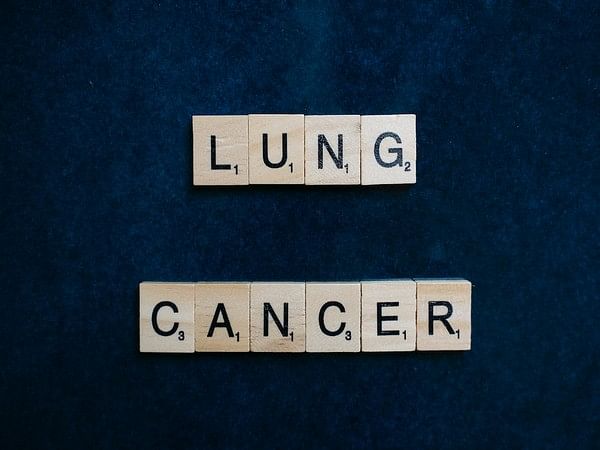 Carbon ultrafine particles accelerate lung cancer progression