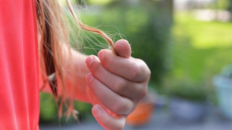 Exosomes are the latest buzzword in hair loss treatments. Do they work for everyone?