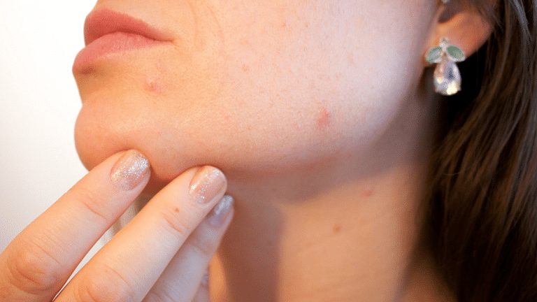 Sibling incest to pimple-popping  — science tells you why disgusting things are captivating