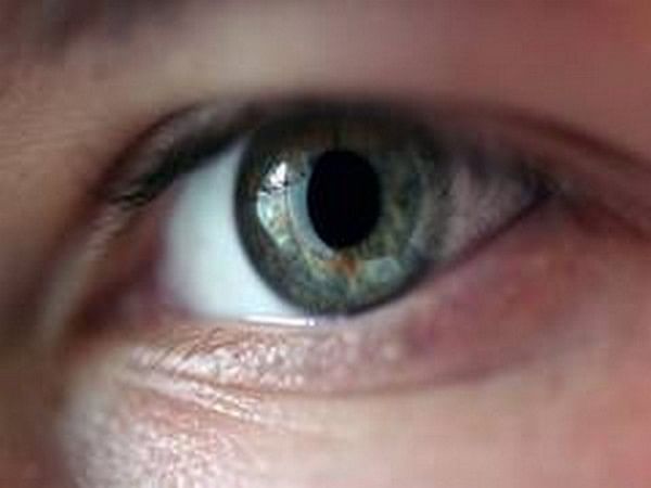 Genetic mutation led to development of severe childhood glaucoma: Study