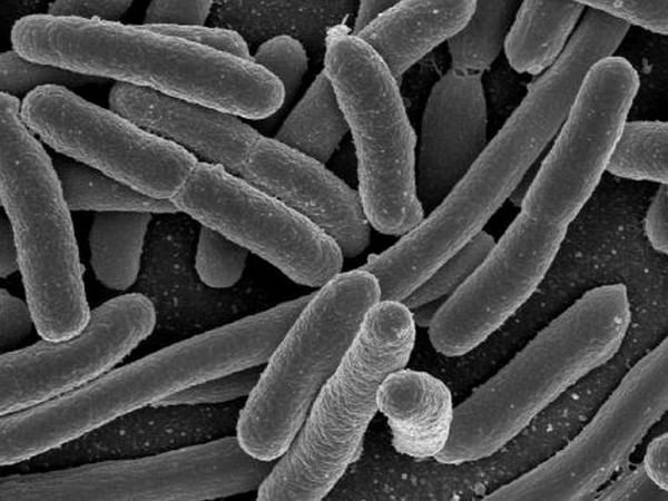 Researchers find how pathogenic bacteria trigger Crohn's disease