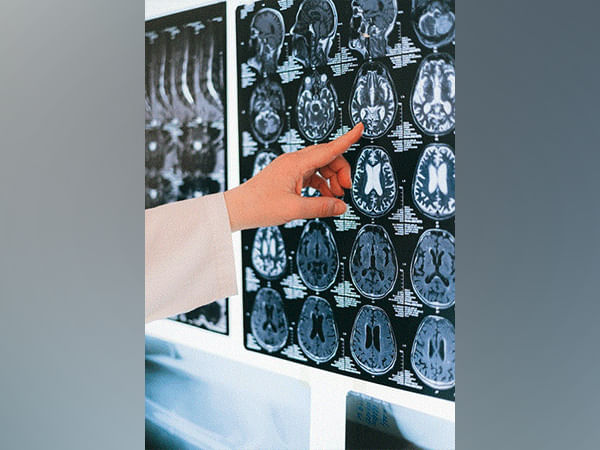 Researchers discover Myelin determines energy management of inhibitory brain cells 