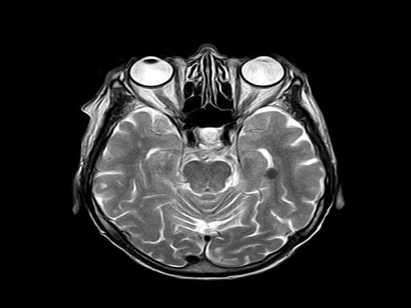 Scientists identify neural circuit that enables self-localization in zebrafish
