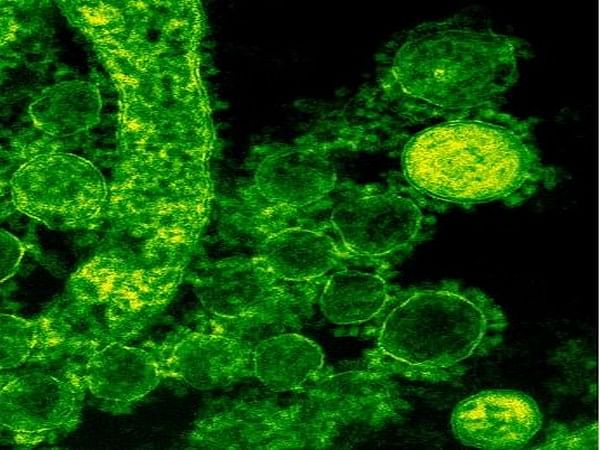 Scientists map key protein structure of Hepatitis C virus