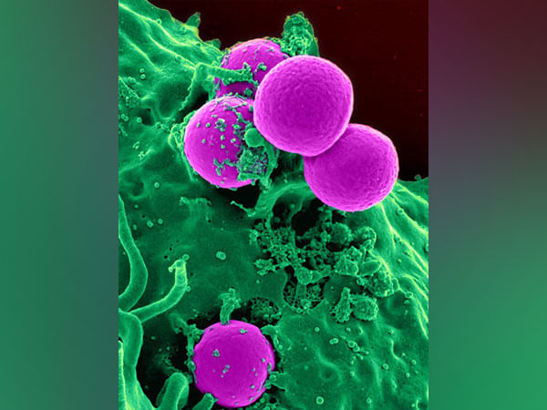 Overactive cell metabolism linked to biological ageing: Research