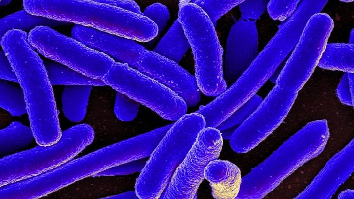 Colorized graphic reproduction of Escherichia coli (E Coli) bacteria. | Commons