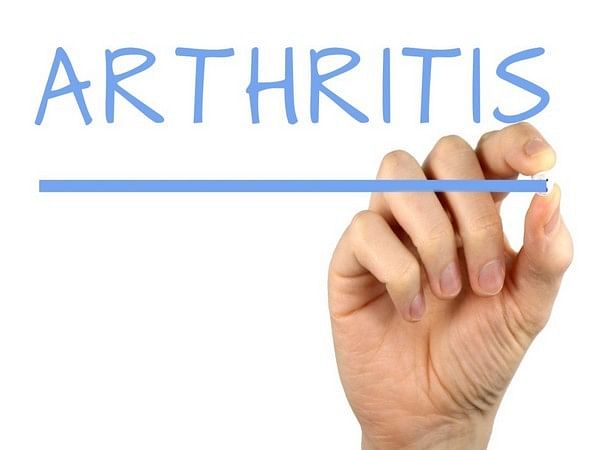 New breakthrough made in treatment of rheumatoid arthritis: Research