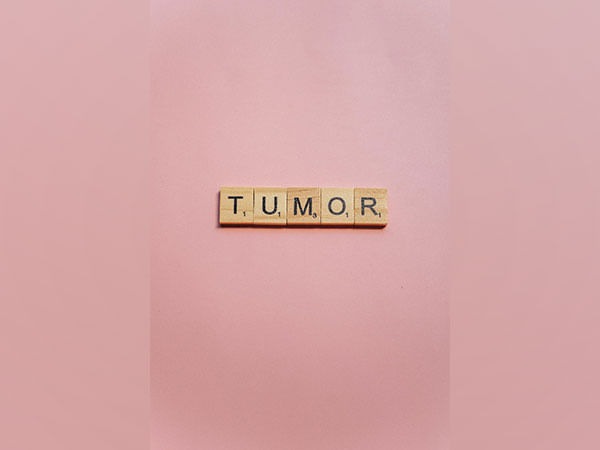 Scientists identify protein that's crucial to tumor cells' metabolism