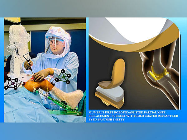 Mumbai's first robotic-assisted partial knee replacement surgery with gold coated implant led by Dr Santosh Shetty marks milestone in orthopedic care