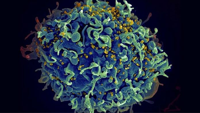 Human T cell (blue) under attack by HIV (yellow), the virus that causes AIDS | Credits: www.nih.gov