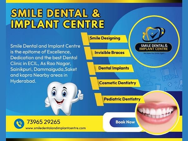 Smile Dental & Implant Centre announces Advanced Dental Care Services in A S Rao Nagar, Ecil Hyderabad