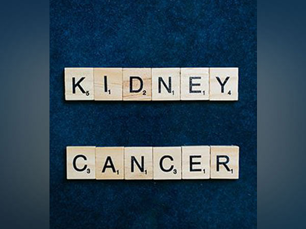 Study finds biomarker can predict how kidney cancer patients respond to ...