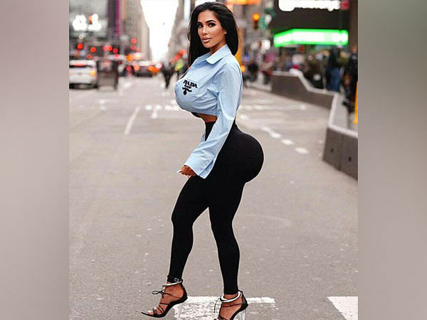 Kim Kardashian lookalike dies of cardiac arrest post plastic surgery 