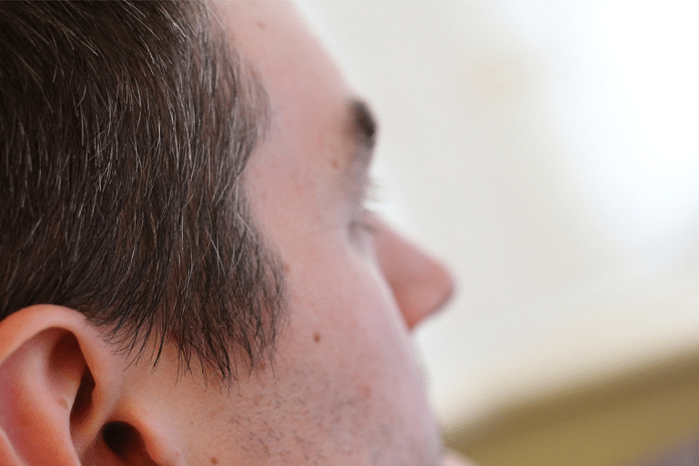 No dye or colour, here is what you can do to avoid the grey hair