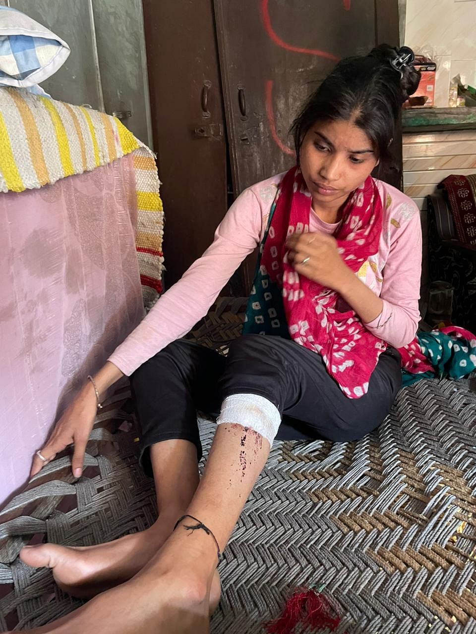 Manija shows her bandaged leg | Sagrika Kissu | ThePrint