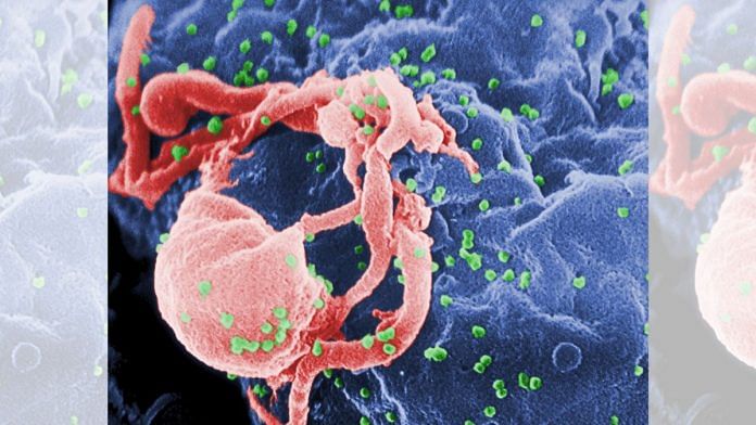 Representational image | Micrograph of HIV-1 budding from cultured lymphocyte | Wikimedia commons
