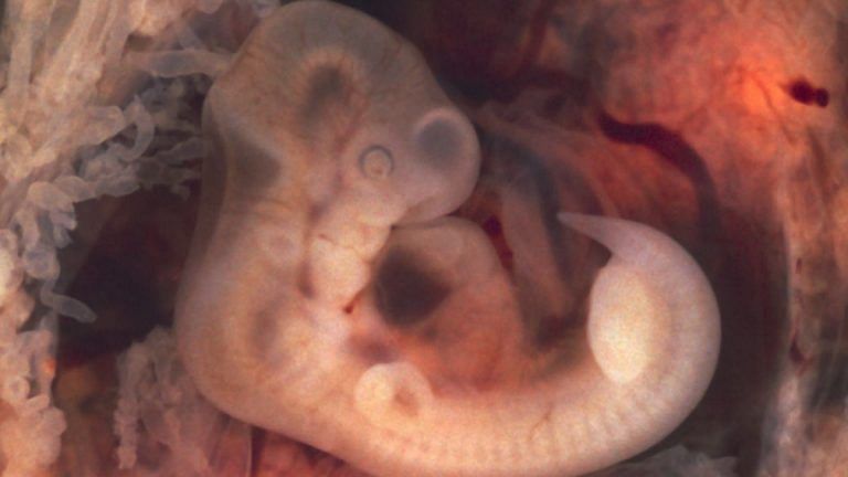Scientists have created synthetic embryos without sperm or ova. But what about ethics?