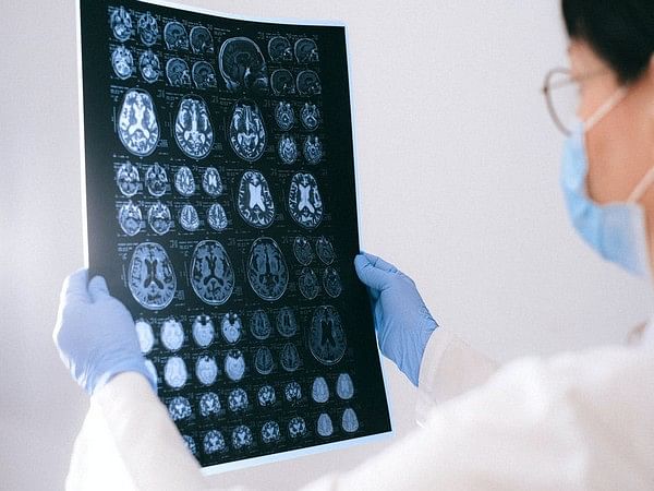 Study reveals how monitoring brain waves reduces post-op complications