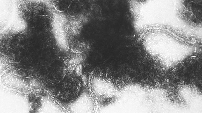 This electron micrograph depicts the Respiratory Syncytial Virus (RSV) pathogen | Wikimedia Commons