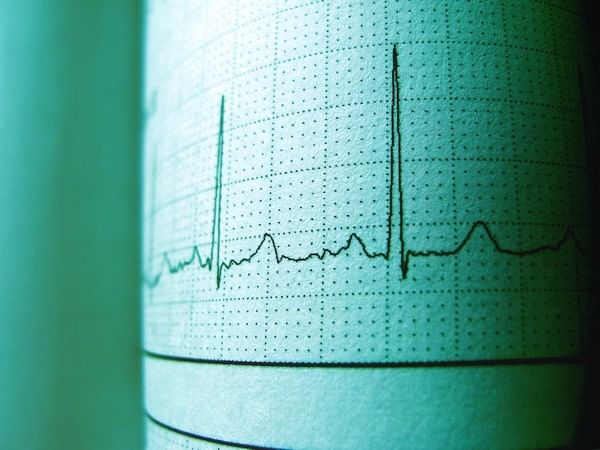 Study finds imaging system that takes diagnosis step further