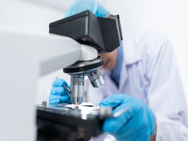 Cough sound analysis help to determine severity of Covid-19 patients 