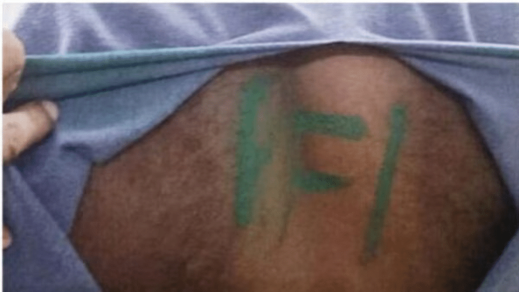 Army jawan Shine Kumar had claimed that six men had tied him and painted 'PFI' on his back | Pic credit: X