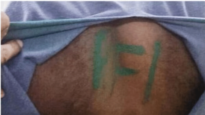 Army jawan Shine Kumar had claimed that six men had tied him and painted 'PFI' on his back | Pic credit: X