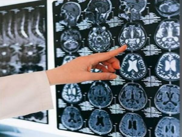 Study investigates what happens in brain when daydreaming