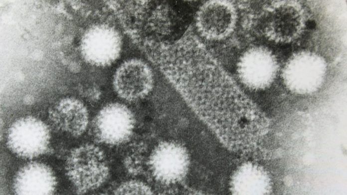 Representational image | Commons