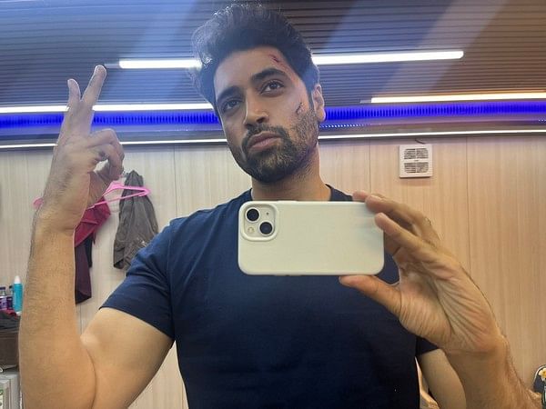 Adivi Sesh flaunts his scars in BTS picture from sets of 'G2'