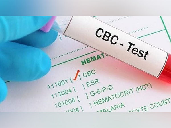 Signs You Require a CBC Test Signs You Require a CBC Test