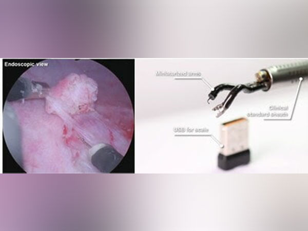 Agilis Robotics Unveils Groundbreaking Advancements in Endoluminal Surgery