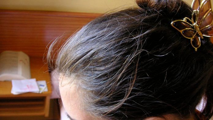 Greying hair