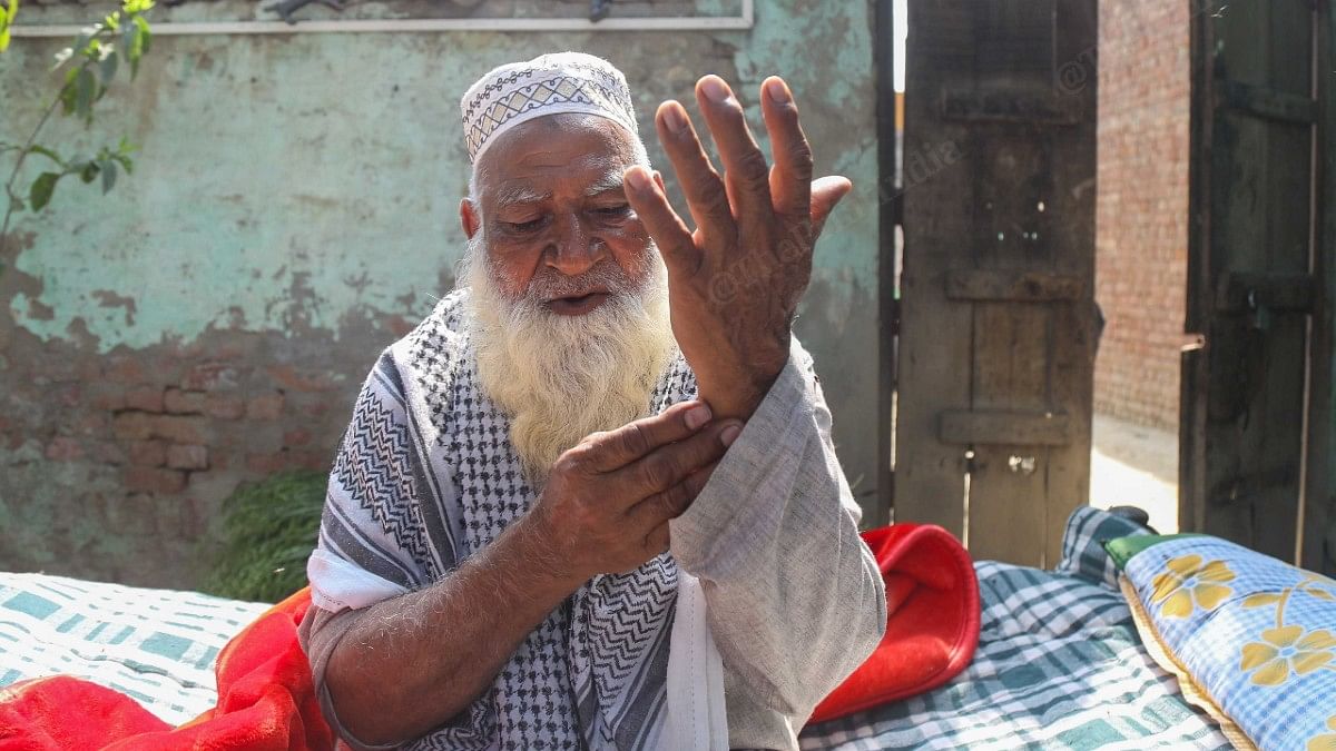 Samaydeen showing the injuries on his hands | Suraj Singh Bisht | ThePrint