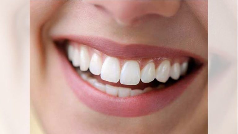 Unveiling the Marvel of Zirconium Crowns in Turkey: A Smile Transformation Journey