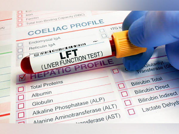 When Should You Get Liver Function Tests Done? Signs and Symptoms that Warrant Testing