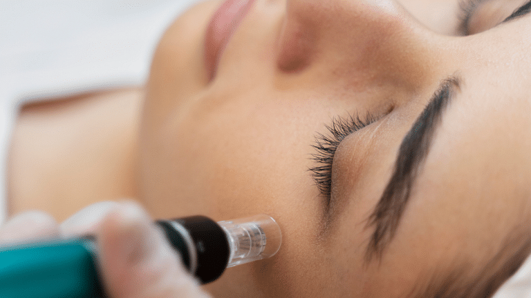Fillers can give the desired look—follow these dos and don’ts