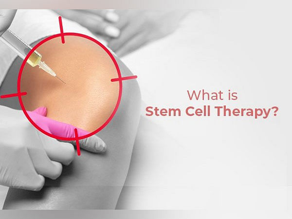 What Is Stem Cell Therapy? How Does It Work?