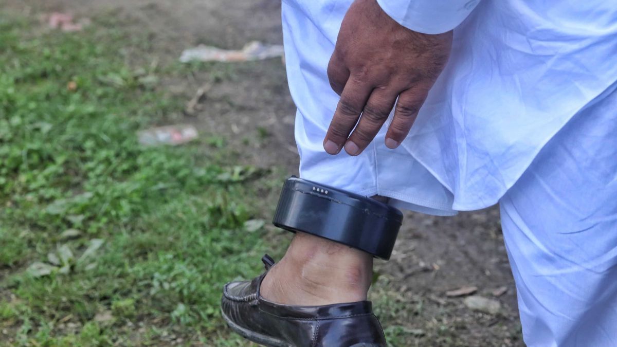 हाफिज़ सिकंदर अपने टखने पर लगे जीपीएस ट्रैकर को दिखाते हुए | फोटो: प्रवीण जैन/दिप्रिंट