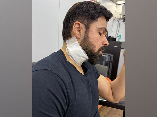 Emraan Hashmi gets injured during 'Goodachari 2' in Hyderabad